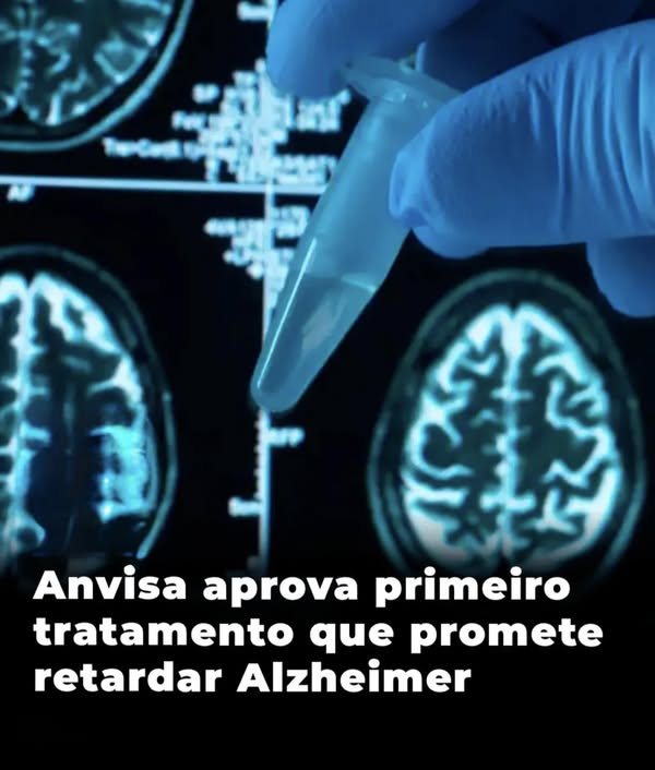 Anvisa aprova primeiro tratamento que promete retardar Alzheimer