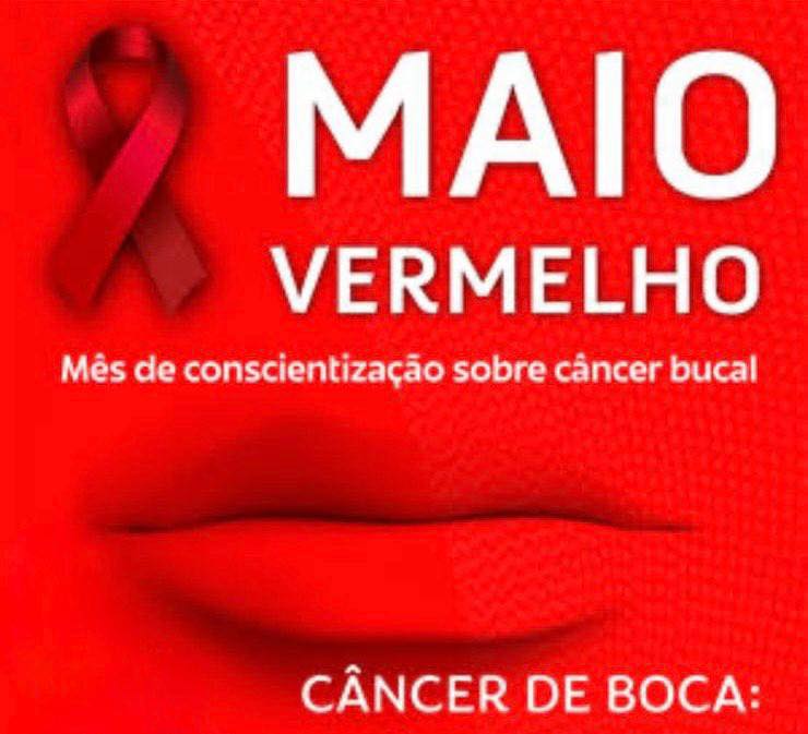Campanha Maio Vermelho alerta para prevenção e diagnóstico precoce do câncer de boca